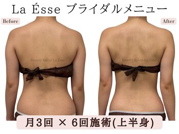 ラエッセ(La Esse)/むくみがとれてすっきり後ろ姿