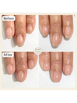 自爪育成　再来