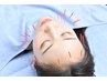 【美容鍼回数券ご利用の方専用】スタンダード