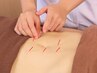 【自律/頭痛/不眠】初めての鍼/自律神経調整鍼灸＋オイルor整体70分￥7700