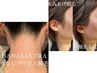 【ワックスと光で綺麗が続く】★もみあげ＋うなじ（ワックス＋美容脱毛)