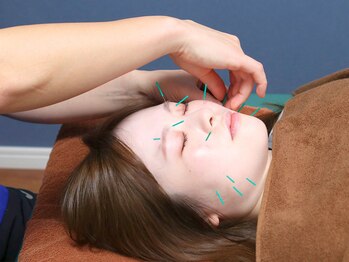 越谷ヘルム鍼灸整体院(越谷HELM鍼灸整体院)/施術後の変化をお楽しみに☆