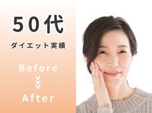 かわの治療院/50代 ダイエットBefore/After