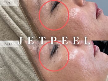 レヴェリー 心斎橋店(REVERIE)/‐ JETPEEL ‐