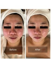 ミンク(Mink)/赤みを抑えて小顔に◎