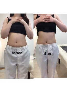 ジョワイユ(Joyeux)/腸の位置でお腹は変わる