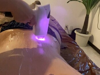 美ららの写真/メンズの濃い髭にもしっかり効果実感のLED脱毛！丁寧な施術で初めての方も始めやすいのでオススメです☆