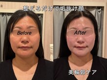 薬手名家 心斎橋店/お客様ビフォーアフター