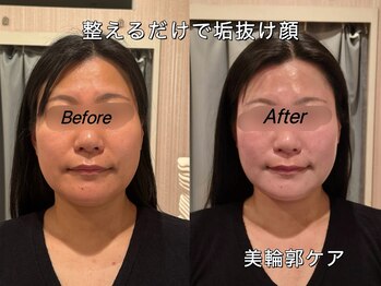 薬手名家 心斎橋店/お客様ビフォーアフター