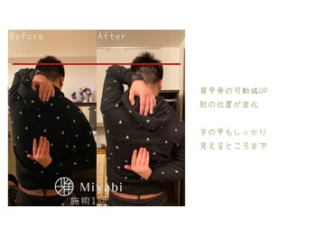 エナジーメソッド雅(miyabi)/肩、腕が動かしにくい方へ