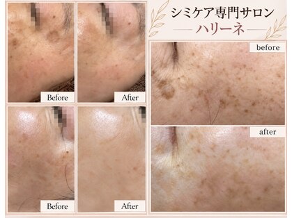 ハリーネ(HARINE)の写真