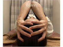 ブリス エナジーアンドサロン 福岡薬院店(bliss energy&salon)/頭筋ほぐし　30分　after