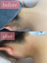 マドンナリリー 恵比寿店(Madonna Lily)/お客様before/after