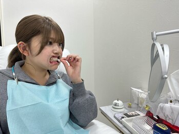 グラスプレイス/【7.コットンロール等の装着】