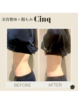 サンク(Cinq)/整体と骨盤矯正で反り腰改善