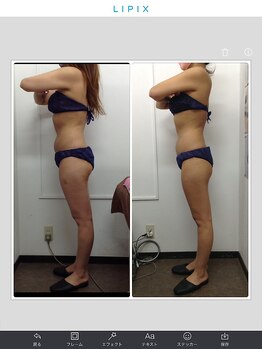 健康痩身研究所 蟹江店/ビフォーアフター