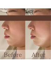 凪眠/小顔リンパフェイシャルの効果39