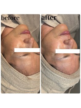 ディオーネ 春日井勝川店(Dione)/マーメイドセルトリートメント