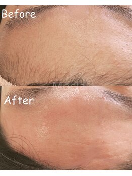 モエラビューティーサロン(Moela beauty salon)/【フェイスワックス】