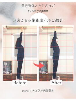ヨギート(yogate)/経絡リンパマッサージ/整体/小顔