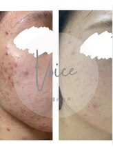 フェルナ(FERNA)/美容カイロプラクティック