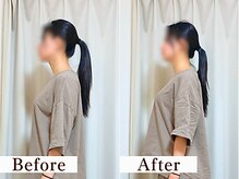 ユルビノ 武蔵小杉(yurubino)/M様／エステティシャン／20代