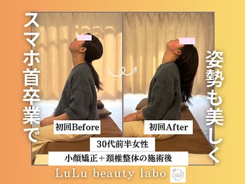 ルルラボ(LuLu beauty labo)/スマホ首改善できれい姿勢