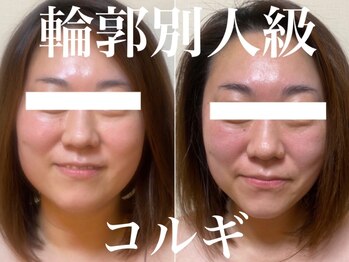 ベリンダ(belinda)の写真/【お顔のお悩み徹底改善】小顔コルギ認定講師が自分史上1番の小顔に導きます！