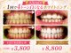 ワイズサロン(Y's salon)の写真