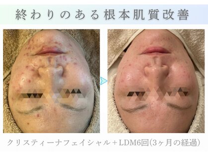 アマテラススキンラウンジ(Amatelas SKIN LOUNGE)の写真