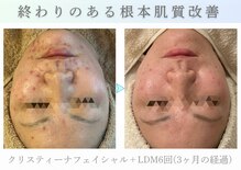 アマテラススキンラウンジ(Amatelas SKIN LOUNGE)