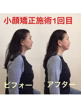 オズ六本木/六本木小顔矯正（造顔）姿勢整う