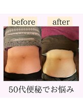 心和(こより)/beforeafter