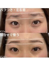 アベイユ 徳島北島店(abeille)/左右差・ばらつきも解決