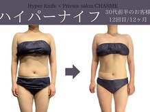 シャルム(charme)/結果重視！ハイパーナイフ痩身