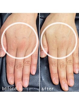 ネイルズ アヴァンティ(Nails Avanti)/ハンド&ネイルケア