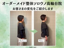 ソロウノ 高輪台院/巻き肩・スマホ首改善