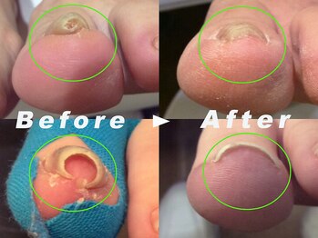 東京巻き爪センター 本院 麻布十番