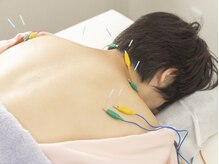 縁/辛い症状に効果抜群 鍼通電療法