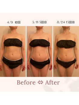 ファミーユ 名古屋店/【経過ビフォーアフター2】