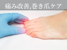 ココネイル(coco.nail)/Foot巻き爪痛み軽減ケア