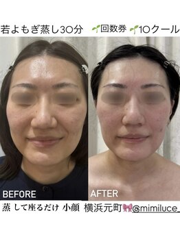 ミミルーチェ(mimiluce)/蒸しただけで透明感あるお肌へ