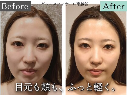 グレースフィオーレ 南越谷店(gracefiore)の写真