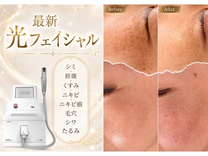 ミーツ(Meets)の写真