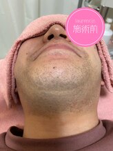 ローランサン(laurencin)/【Before2】