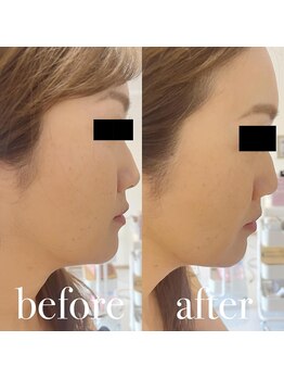 ルルアス(LUluas)/