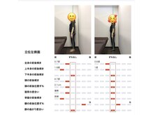 ベル/【20代】姿勢Before After