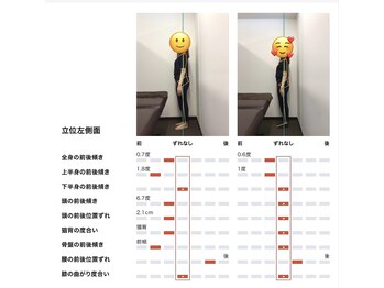 ベル/【20代】姿勢Before After