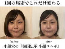 小顔矯正コルギ専門店 小顔堂 心斎橋店
