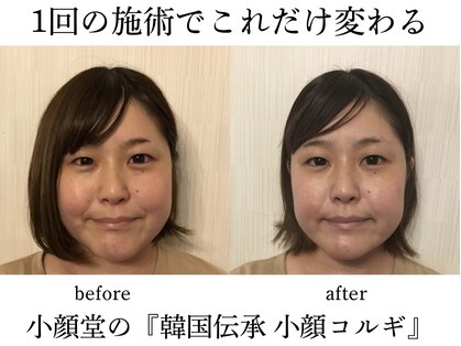 小顔矯正コルギ専門店 小顔堂 心斎橋店の写真